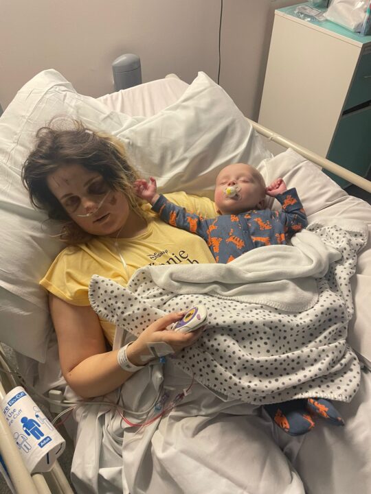 Abigail lay in a hospital bed with severe injuries 